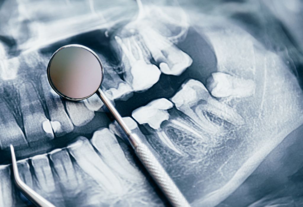 cirurgia oral